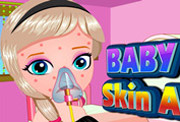 game Baby Elsa Skin Allergy